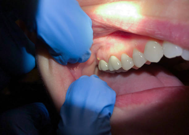 Best Emergency Cosmetic Dentistry (e.g., broken veneers) in Jacksboro, TN